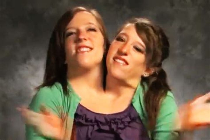 Abby and Brittany Death: The Tragic Tale of the World's Most Famous Conjoined Twins