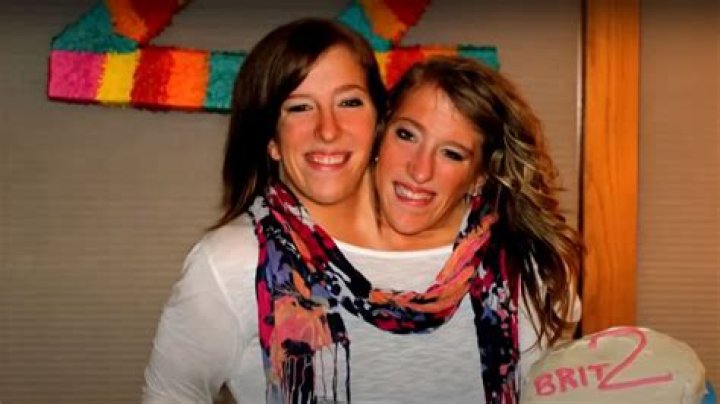 Did Abby and Brittany Hensel Pass Away? Exploring the Lives and Legacy of the Famous Conjoined Twins