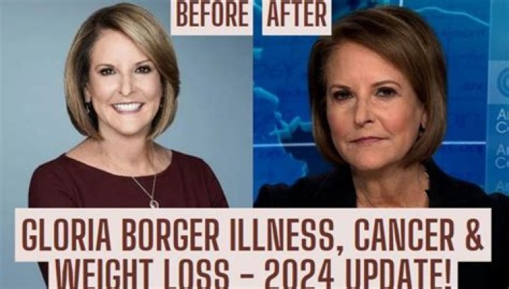 Gloria Borger Illness: An In-Depth Look at Her Health Journey