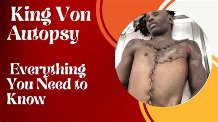 King Von Autopsy Released: A Detailed Examination