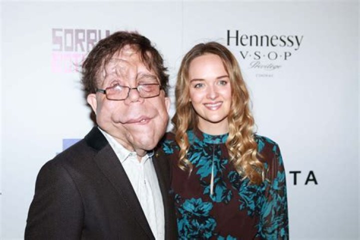 Lovetory Adam Pearson and His Dedicated Wife: A Heartfelt Journey