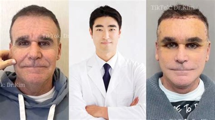 Mercedeschlapp Facesurgery: Exploring the Transformation Procedure and Impact