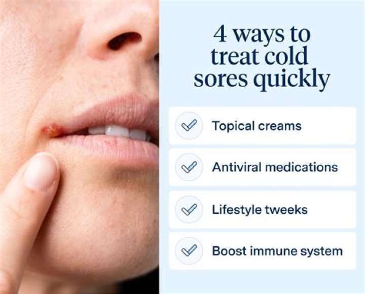 Should You Pop Cold Sores? The Ultimate Guide to Cold Sore Management