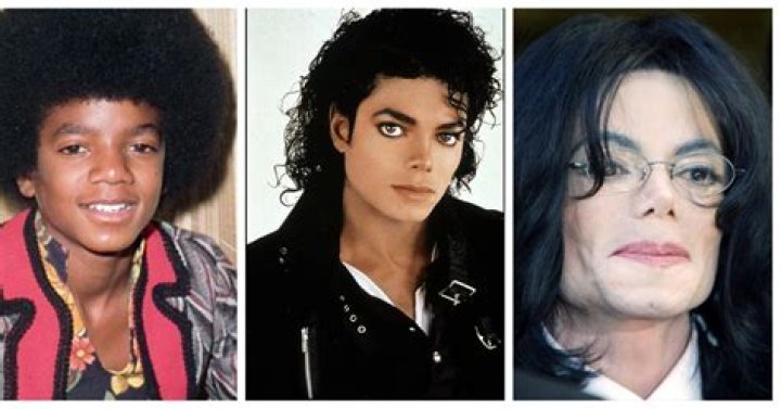Understanding Michael Jackson's Vitiligo: A Comprehensive Guide