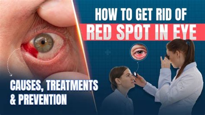 Understanding Red Bumps by the Eye: Causes, Treatments, and Prevention