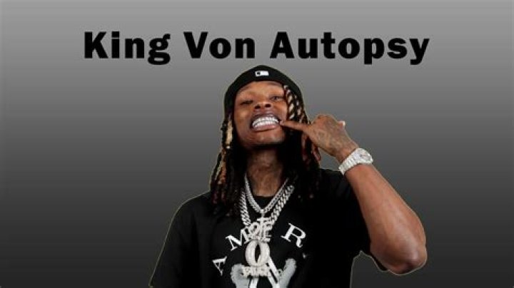 Unraveling the Mystery of King Von Autopsy: A Comprehensive Analysis